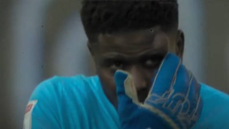 (FOTO/VIDEO) Golmanu Notingem Foresta se izdeformisalo lice nakon sudara sa protivnikom