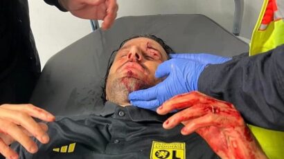 (VIDEO/FOTO) Huligani kamenovali autobus Liona: Fabio Groso u krvi prevezen u bolnicu